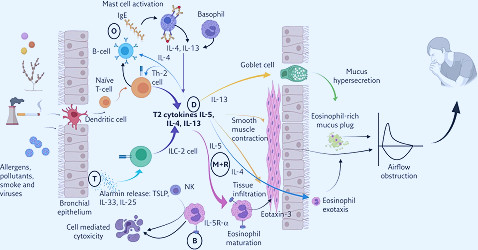 A pragmatic guide to choosing biologic therapies in severe asthma |  European Respiratory Society